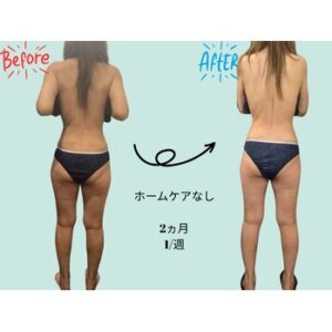 ビフォーアフター２（メディライン）
