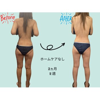 ビフォーアフター２（メディライン）