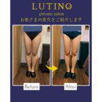 ビフォーアフター(メディライン)