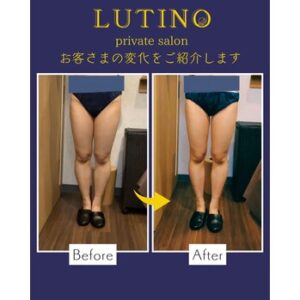 ビフォーアフター（メディライン）